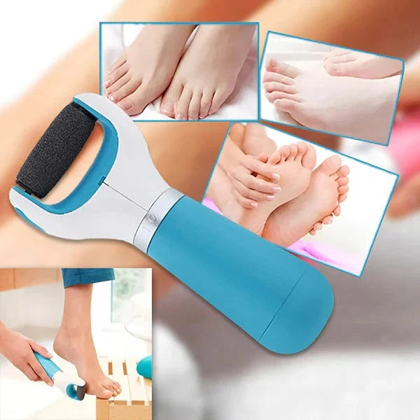 USB Powered Dead Skin Grinder for Feet with Replaceable Roller Heads and Two Speeds