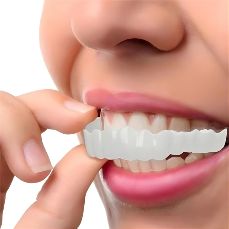 Full Dental Veneer Kit – Upper & Lower Cosmetic Covers
