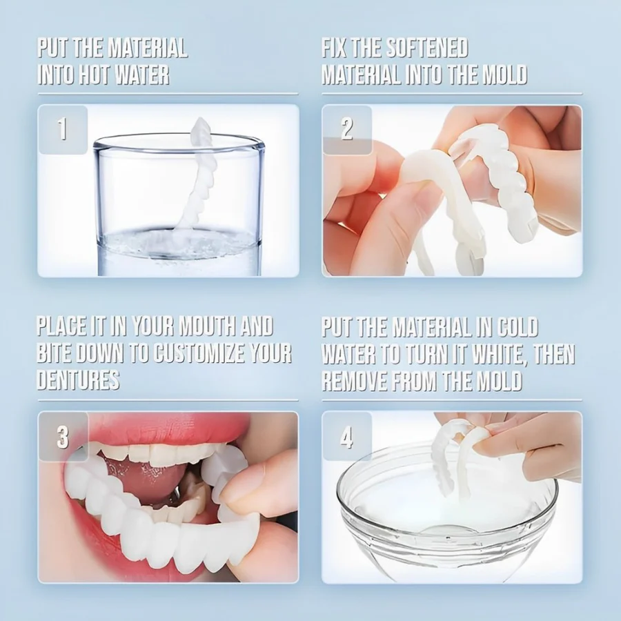 Full Dental Veneer Kit – Upper & Lower Cosmetic Covers