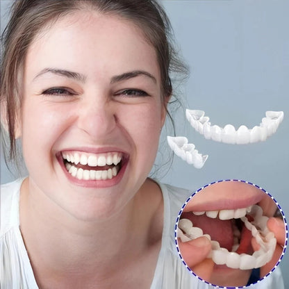 Full Dental Veneer Kit – Upper & Lower Cosmetic Covers