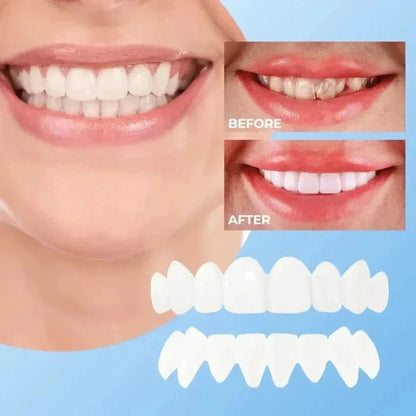Clip On Cosmetic Veneers and Temporary Tooth Covers