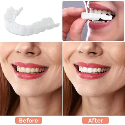 Clip On Cosmetic Veneers and Temporary Tooth Covers
