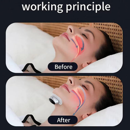 Snoring Support Device with Automatic Stimulation Adjustment