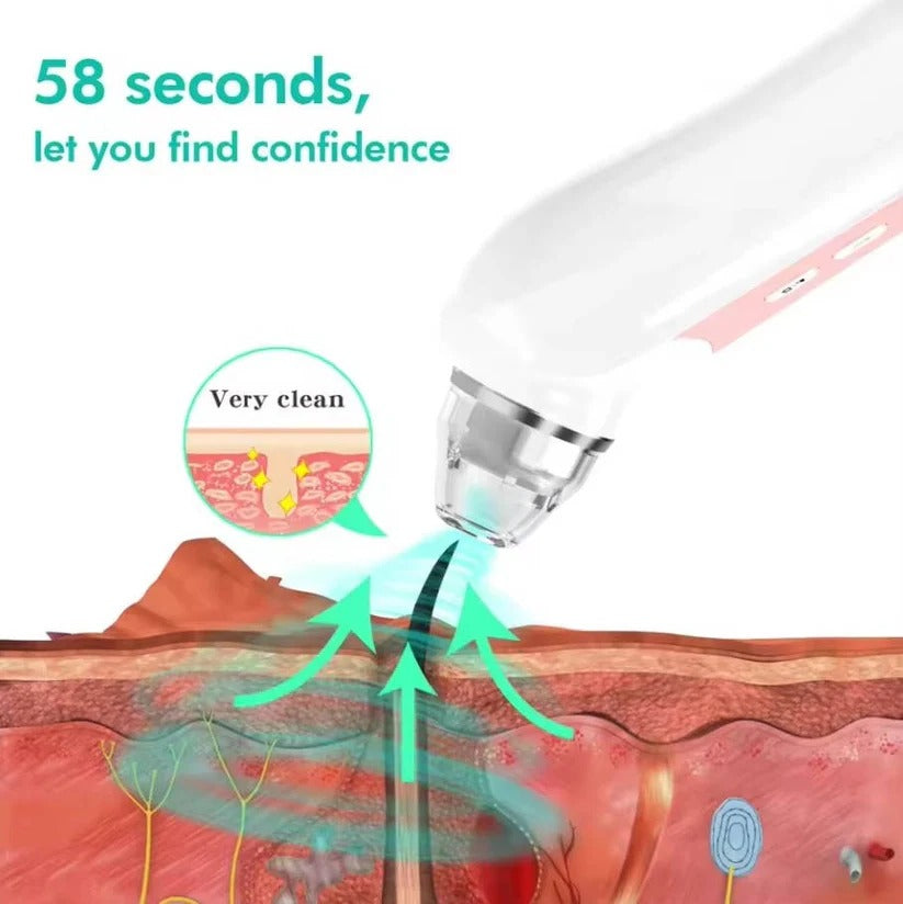 Pore Vacuum Extractor with Built-In Camera and Rechargeable Battery
