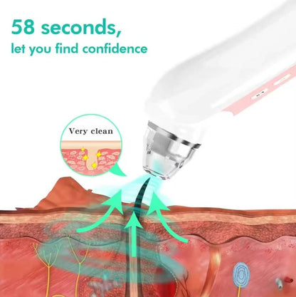Pore Vacuum Extractor with Built-In Camera and Rechargeable Battery