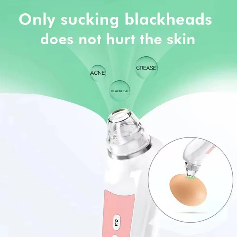 Pore Vacuum Extractor with Built-In Camera and Rechargeable Battery