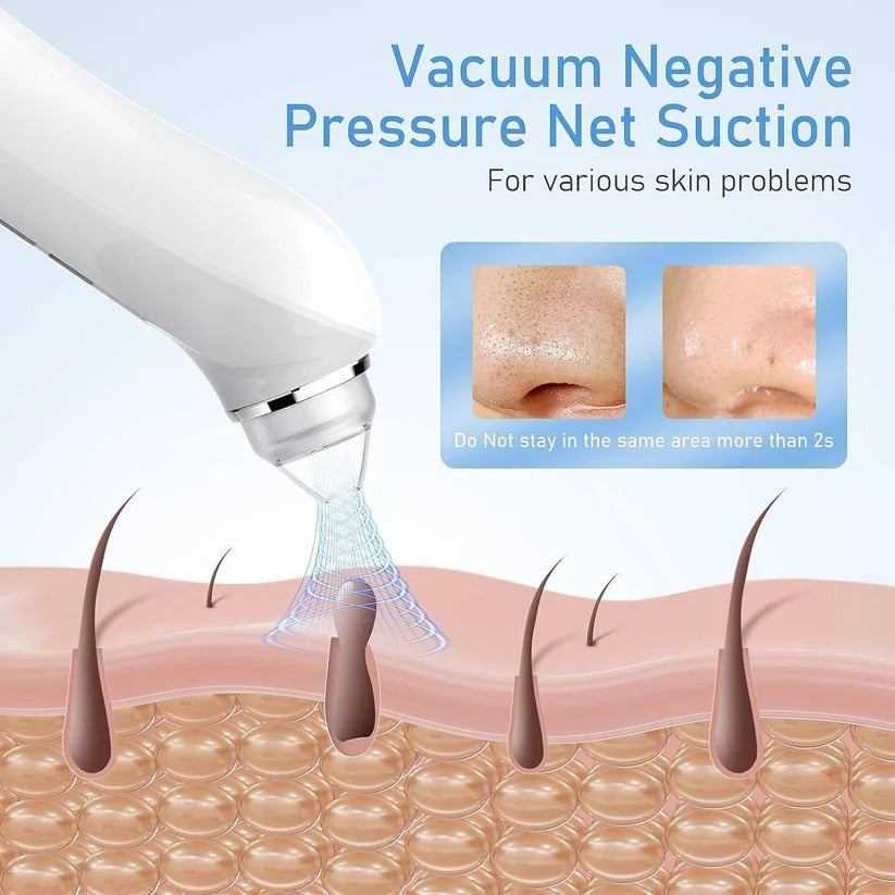 Pore Vacuum Extractor with Built-In Camera and Rechargeable Battery