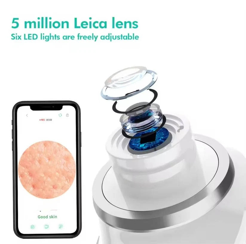 Pore Vacuum Extractor with Built-In Camera and Rechargeable Battery