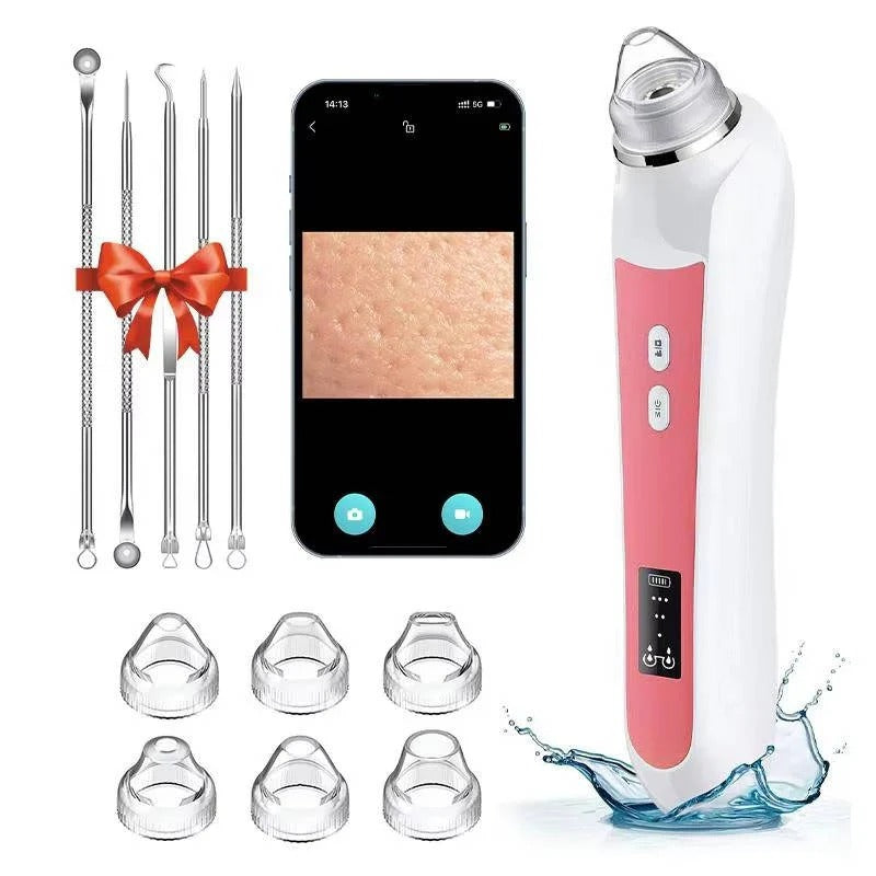 Pore Vacuum Extractor with Built-In Camera and Rechargeable Battery