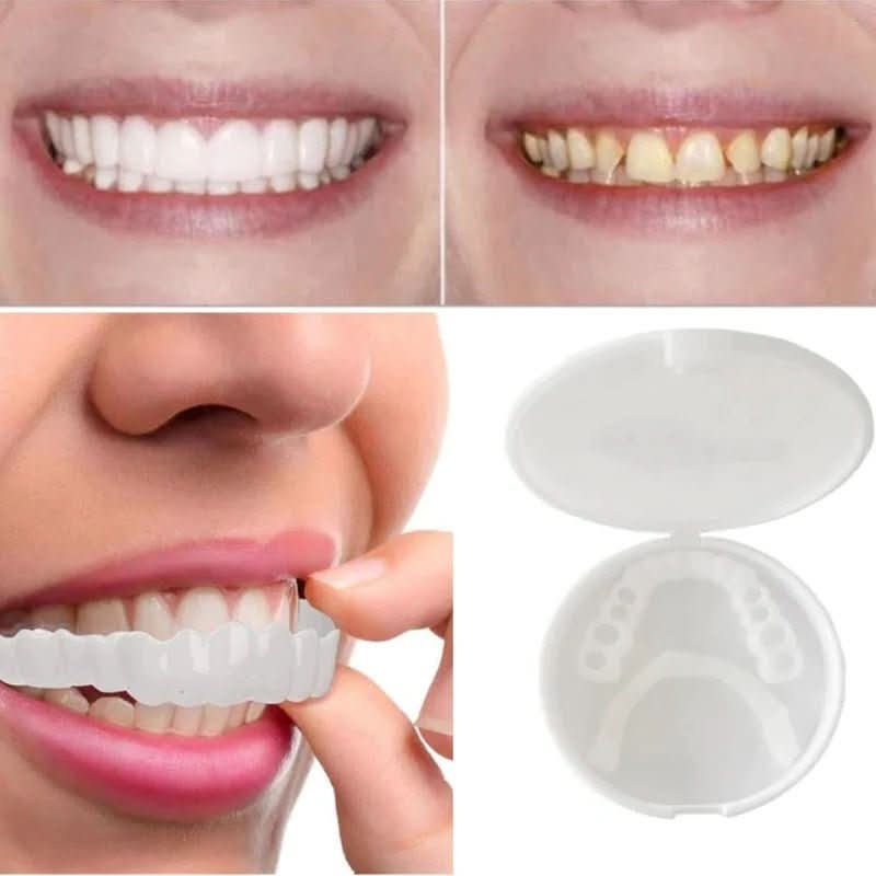 Reusable Snap On Tooth Cover with Heat Moldable Fit and White Finish