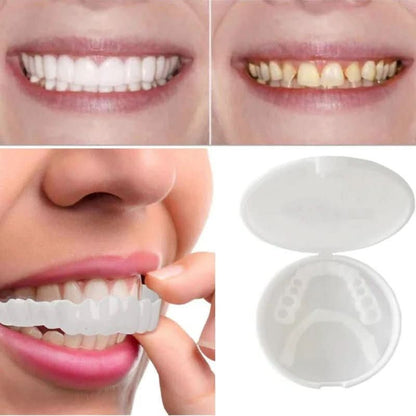Reusable Snap On Tooth Cover with Heat Moldable Fit and White Finish