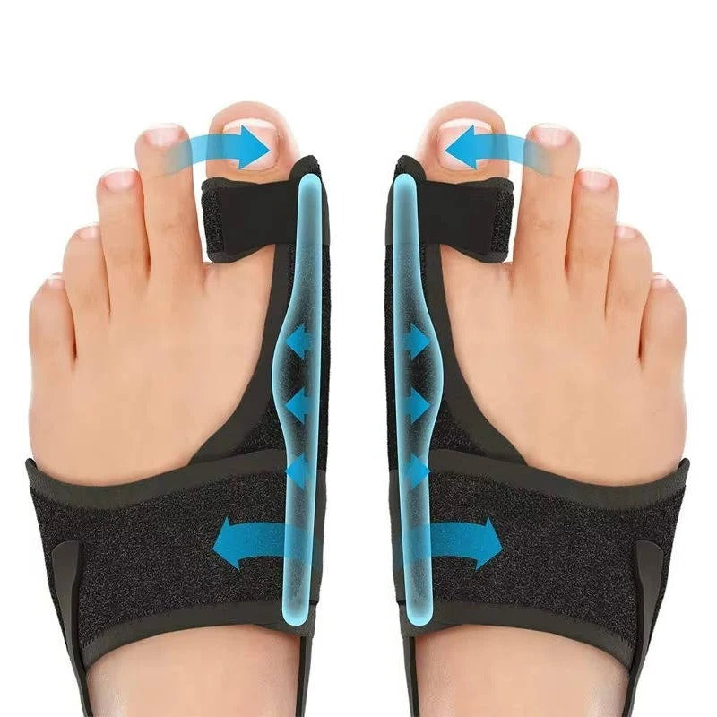Adjustable Toe Splint Brace for Bunion Support, 2 Pack