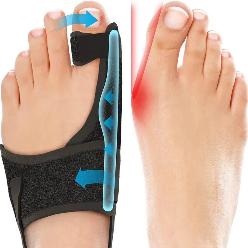Adjustable Toe Splint Brace for Bunion Support, 2 Pack