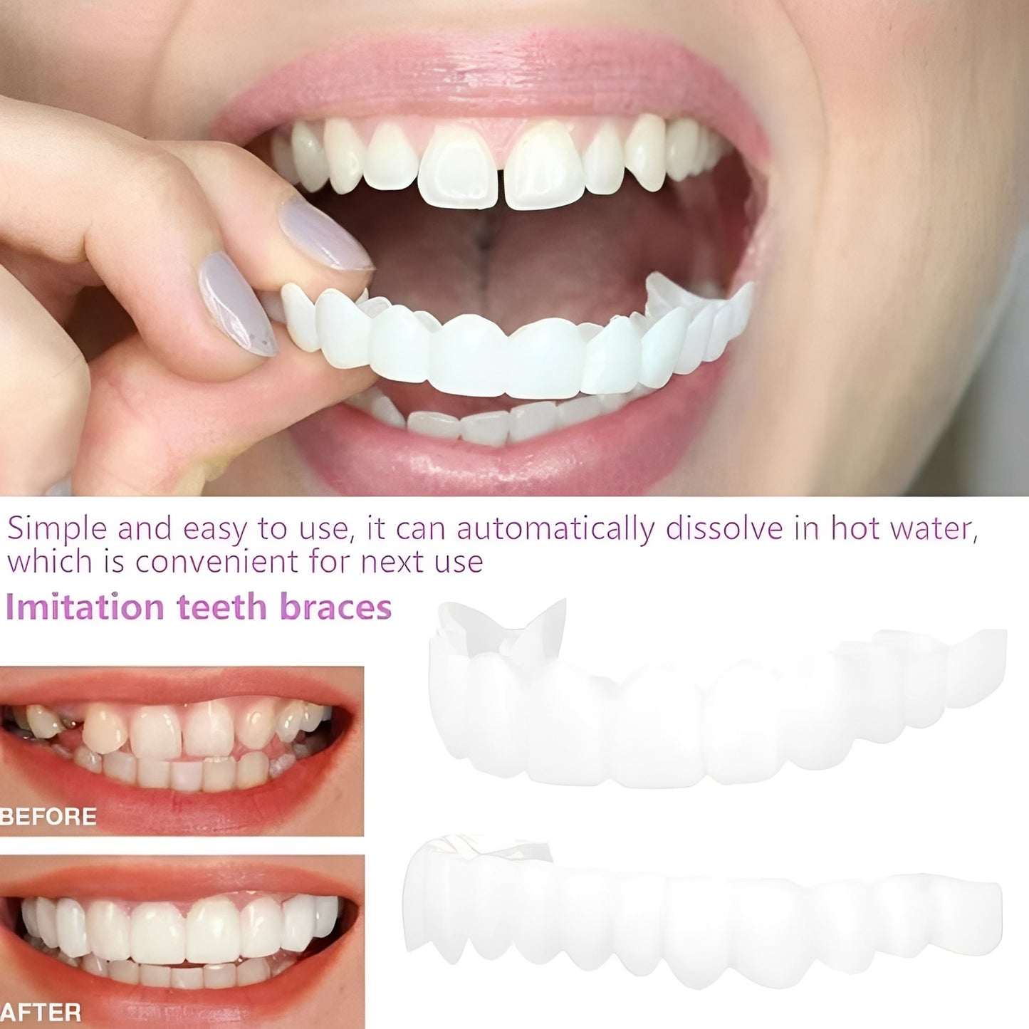 Snap On Cosmetic Tooth Covers for Adults, 2 Piece Set